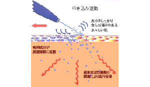 イオン導入